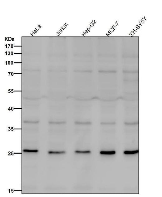 Anti-Neurogenin 2 Rabbit Monoclonal Antibody Boster Bio