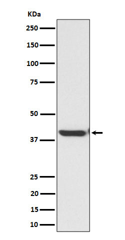 Anti-ENDOGL1 / ENGL Rabbit Monoclonal Antibody Boster Bio