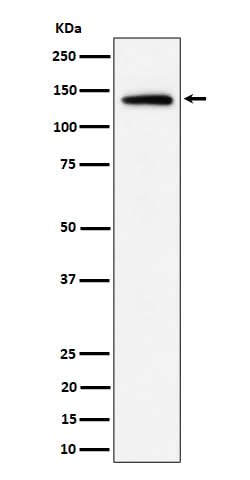Anti-Importin 9 / RANBP9 Rabbit Monoclonal Antibody Boster Bio