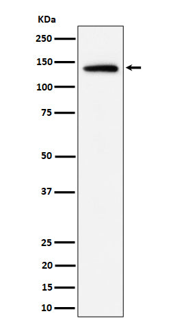 Anti-Importin 9 / RANBP9 Rabbit Monoclonal Antibody Boster Bio