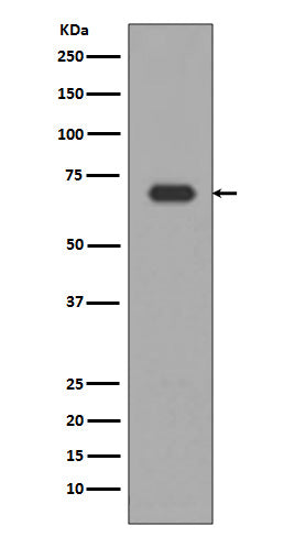 Anti-Alas1/Alas H Rabbit Monoclonal Antibody Boster Bio