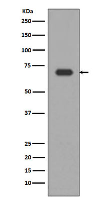 Anti-Alas1/Alas H Rabbit Monoclonal Antibody Boster Bio