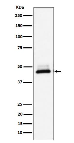 Anti-DNAJA4 Rabbit Monoclonal Antibody Boster Bio