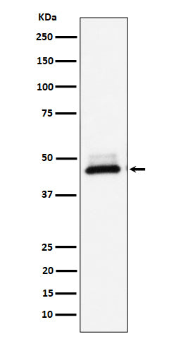 Anti-DNAJA4 Rabbit Monoclonal Antibody Boster Bio