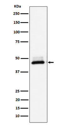Anti-DNAJA4 Rabbit Monoclonal Antibody Boster Bio