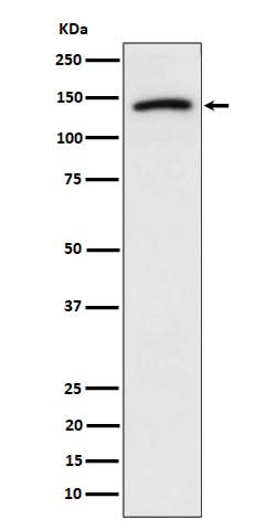 Anti-Cadherin 10 Rabbit Monoclonal Antibody Boster Bio
