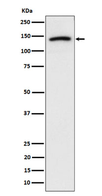Anti-Cadherin 10 Rabbit Monoclonal Antibody Boster Bio
