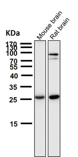 Anti-SCGN Monoclonal Antibody Boster Bio