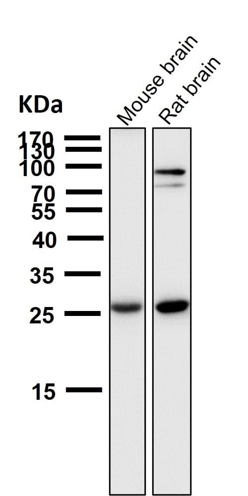 Anti-SCGN Monoclonal Antibody Boster Bio