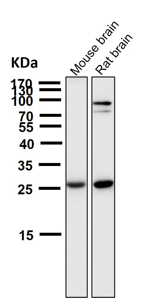 Anti-SCGN Monoclonal Antibody Boster Bio