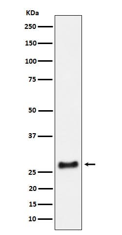 Anti-SNRPA1 Rabbit Monoclonal Antibody Boster Bio