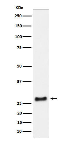 Anti-SNRPA1 Rabbit Monoclonal Antibody Boster Bio