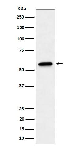 Anti-SF3A3 Rabbit Monoclonal Antibody Boster Bio