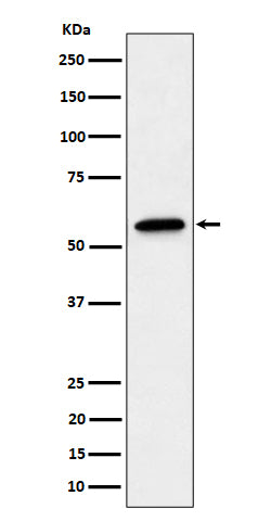 Anti-SF3A3 Rabbit Monoclonal Antibody Boster Bio