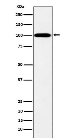 Anti-MYO19 Rabbit Monoclonal Antibody Boster Bio