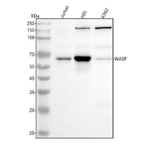 Anti-WASP Rabbit Monoclonal Antibody Boster Bio
