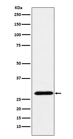 Anti-RGS18 Rabbit Monoclonal Antibody Boster Bio