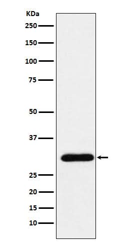Anti-GTF2F2 Rabbit Monoclonal Antibody Boster Bio