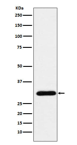 Anti-GTF2F2 Rabbit Monoclonal Antibody Boster Bio