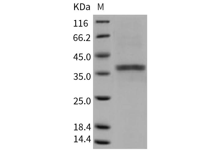 Recombinant Mouse ACP5/TRAP Protein (His Tag) - ABMIUM
