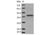 Recombinant Mouse ACP5/TRAP Protein (His Tag) - ABMIUM