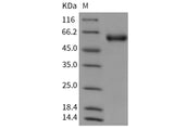 Recombinant Mouse SerpinA8/AGT Protein (His Tag) - ABMIUM