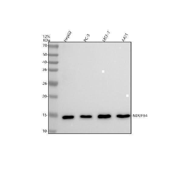 Anti-NDUFB4 Rabbit Monoclonal Antibody Boster Bio