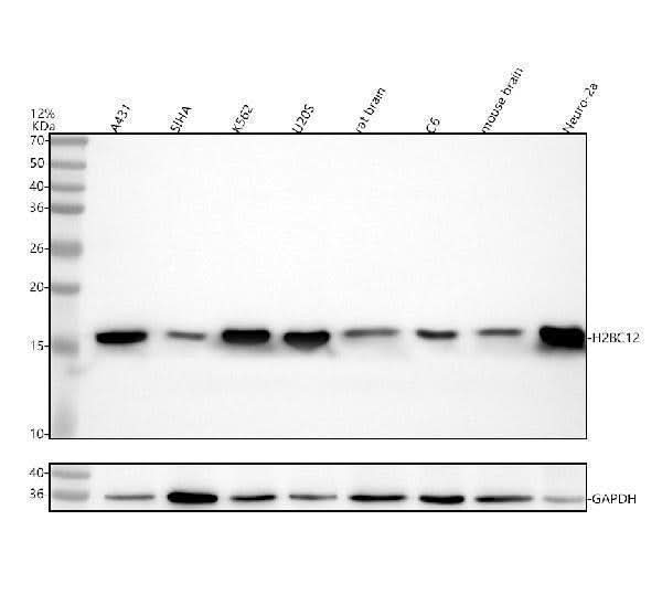 Anti-Histone H2B Rabbit Monoclonal Antibody Boster Bio