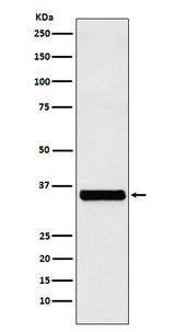 Anti-EXOSC7 Rabbit Monoclonal Antibody Boster Bio