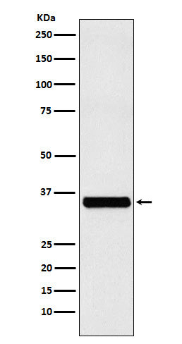 Anti-EXOSC7 Rabbit Monoclonal Antibody Boster Bio