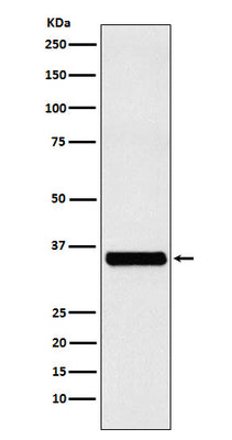 Anti-EXOSC7 Rabbit Monoclonal Antibody Boster Bio