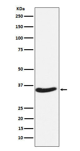 Anti-EXOSC7 Rabbit Monoclonal Antibody Boster Bio