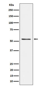 Anti-Prostein Rabbit Monoclonal Antibody Boster Bio
