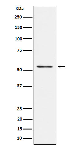 Anti-Prostein Rabbit Monoclonal Antibody Boster Bio
