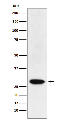 Anti-MAD3 Rabbit Monoclonal Antibody Boster Bio
