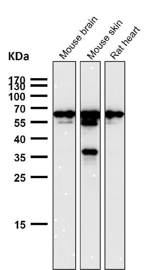 Anti-TFIIE alpha Rabbit Monoclonal Antibody Boster Bio