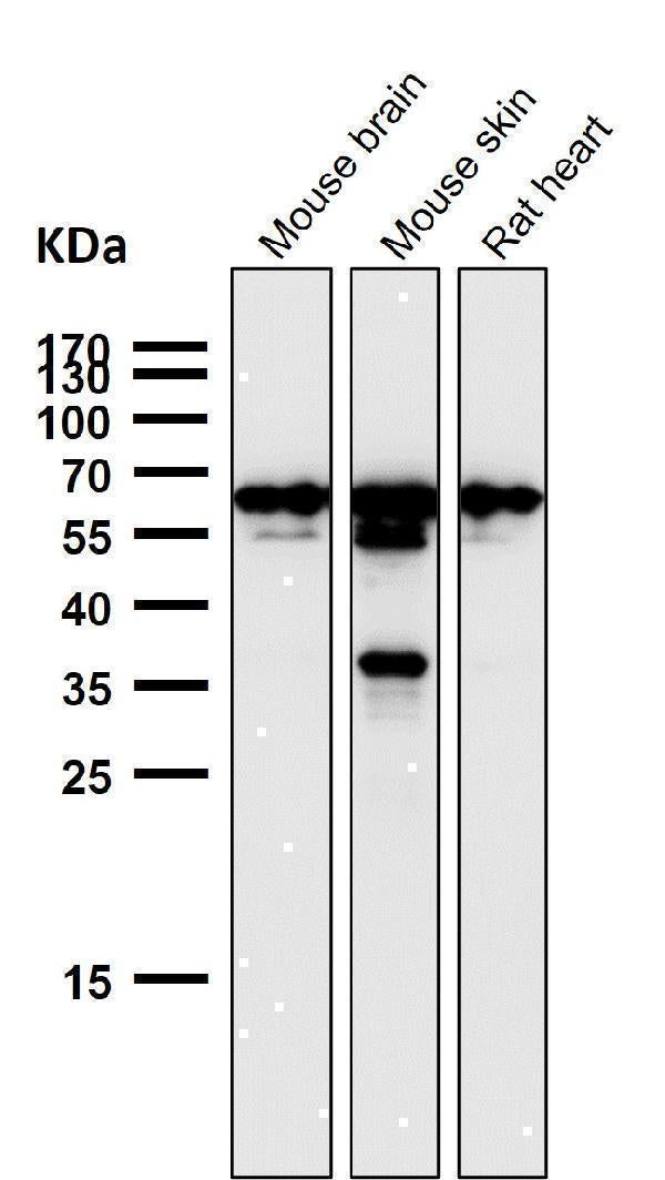 Anti-TFIIE alpha Rabbit Monoclonal Antibody Boster Bio