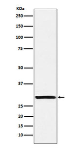 Anti-Intra Acrosomal Protein Rabbit Monoclonal Antibody Boster Bio