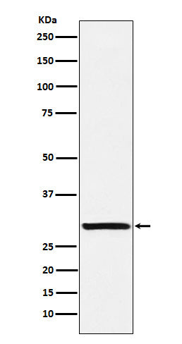 Anti-Intra Acrosomal Protein Rabbit Monoclonal Antibody Boster Bio