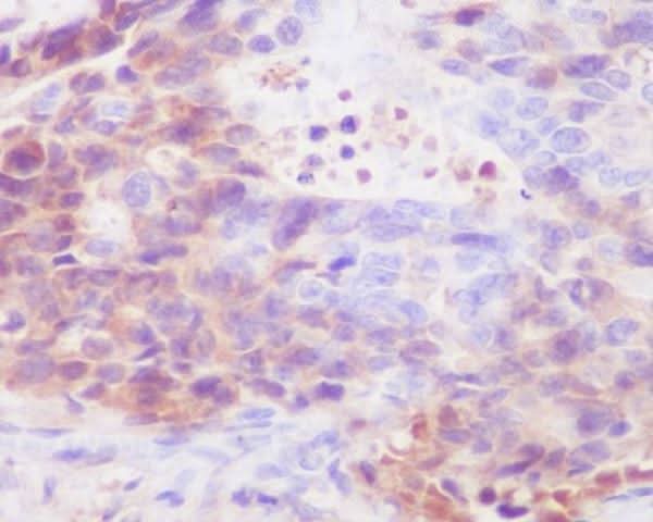 Anti-IgG4 IGHG4 Rabbit Monoclonal Antibody Boster Bio