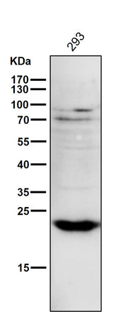 Anti-PPP1R1A Rabbit Monoclonal Antibody Boster Bio