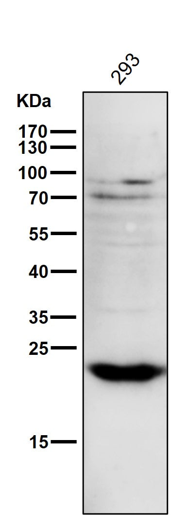 Anti-PPP1R1A Rabbit Monoclonal Antibody Boster Bio
