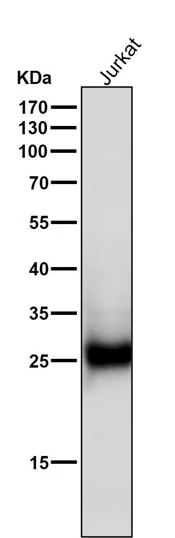 Anti-ZNRF2 Rabbit Monoclonal Antibody Boster Bio