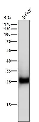 Anti-ZNRF2 Rabbit Monoclonal Antibody Boster Bio