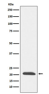 Anti-DCTN3 Rabbit Monoclonal Antibody Boster Bio
