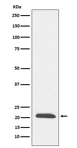 Anti-DCTN3 Rabbit Monoclonal Antibody Boster Bio