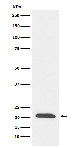 Anti-DCTN3 Rabbit Monoclonal Antibody Boster Bio
