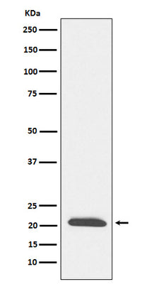 Anti-DCTN3 Rabbit Monoclonal Antibody Boster Bio