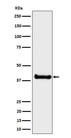 Anti-ALS2CR1 Rabbit Monoclonal Antibody Boster Bio