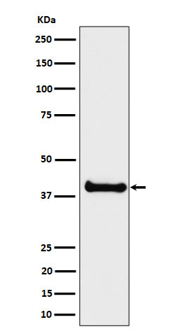 Anti-ALS2CR1 Rabbit Monoclonal Antibody Boster Bio